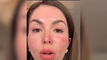 FGJEM atiende denuncia de robo violento a Evelyn “N”; la víctima denuncia amenazas