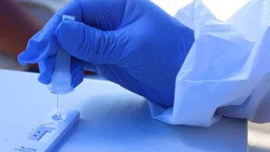 UNAM ofrece estudios de sangre desde 50 pesos