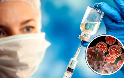 Tras confirmarse la primera muerte por sarampión en CDMX, autoridades revelan cuáles son las alcaldías con más casos activos.