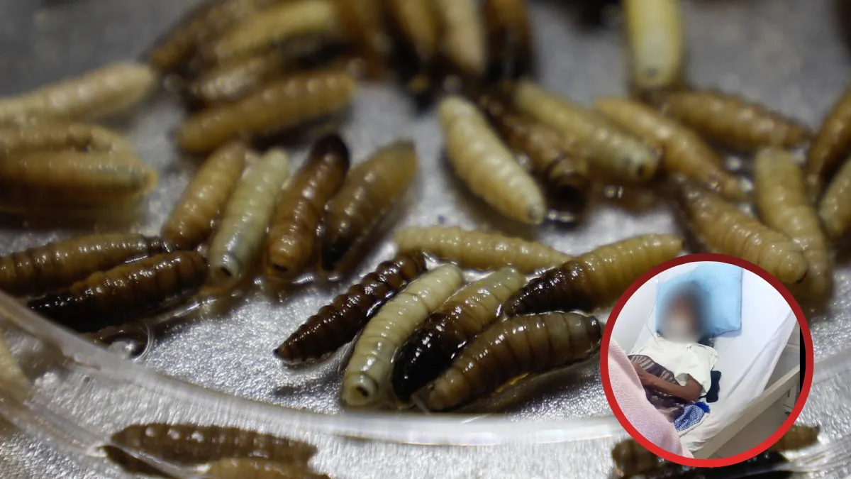 Secretaría de Salud confirma primer caso de gusano barrenador en humanos en Edomex