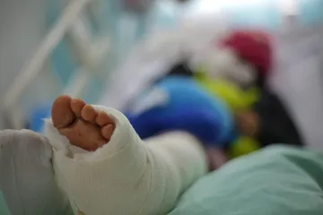 Alcalde de Ecatepec paga cirugías a niña arrollada por el Mexibús