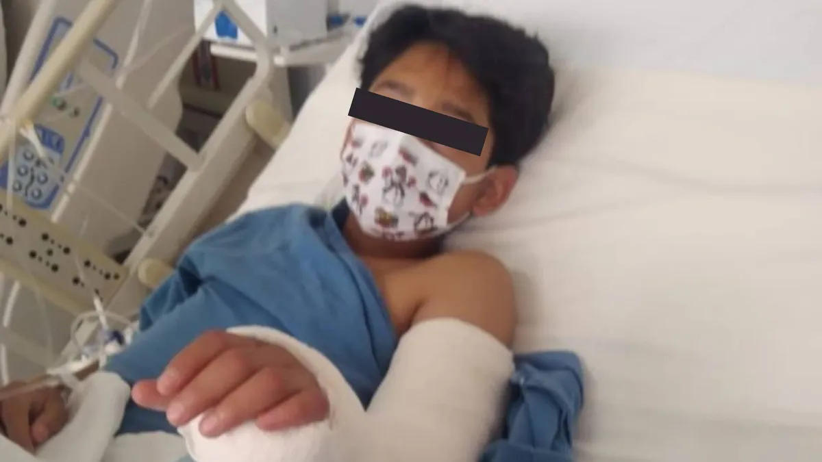 Trabajadora del Tren Maya pide ayuda por hijo lesionado en Tepetlaoxtoc