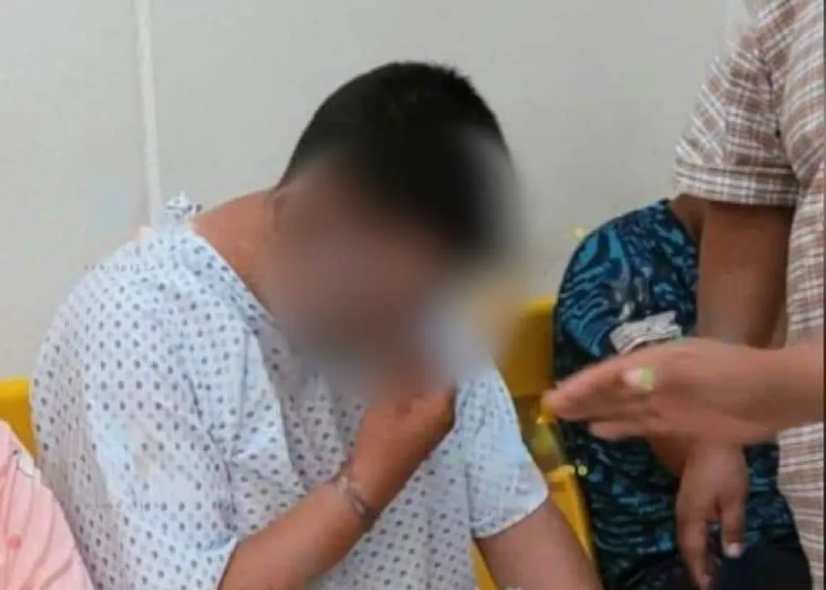 Rostro del piloto del globo aerostático en Teotihuacán quedó totalmente quemado