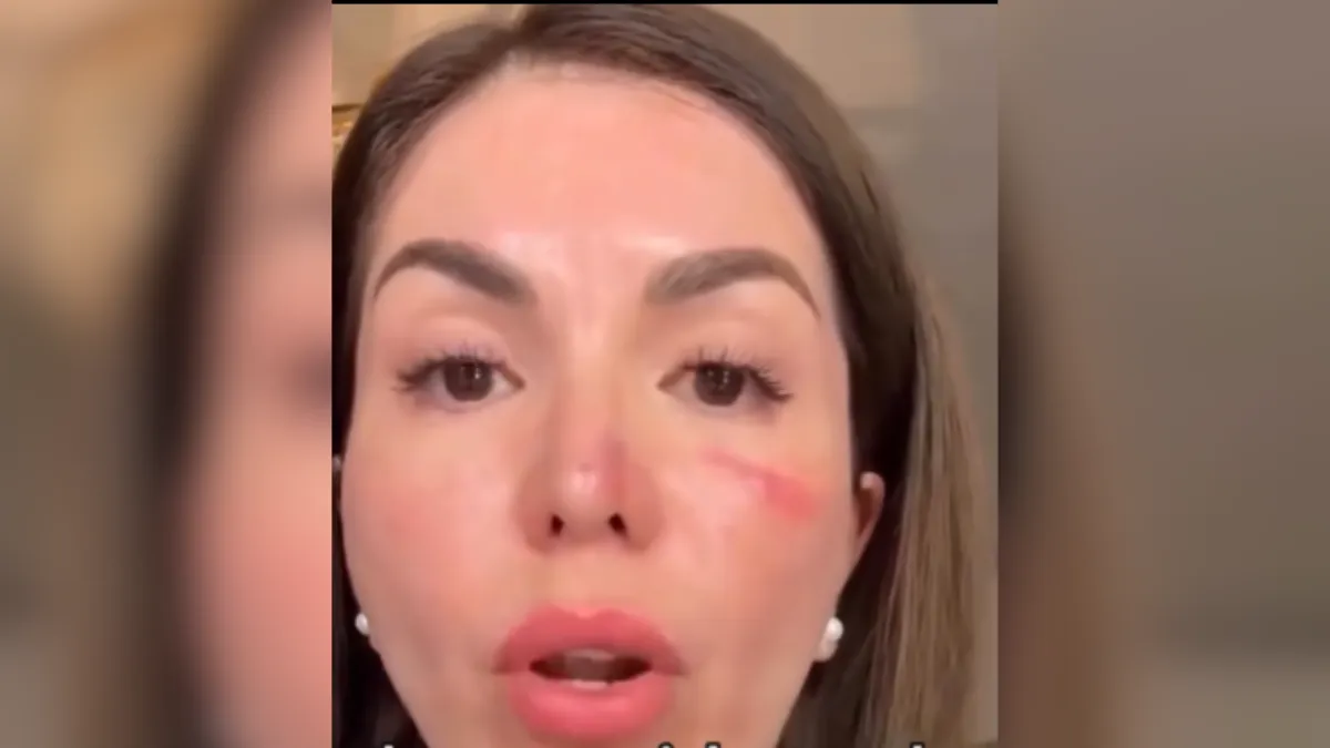 FGJEM atiende denuncia de robo violento a Evelyn “N”; la víctima denuncia amenazas