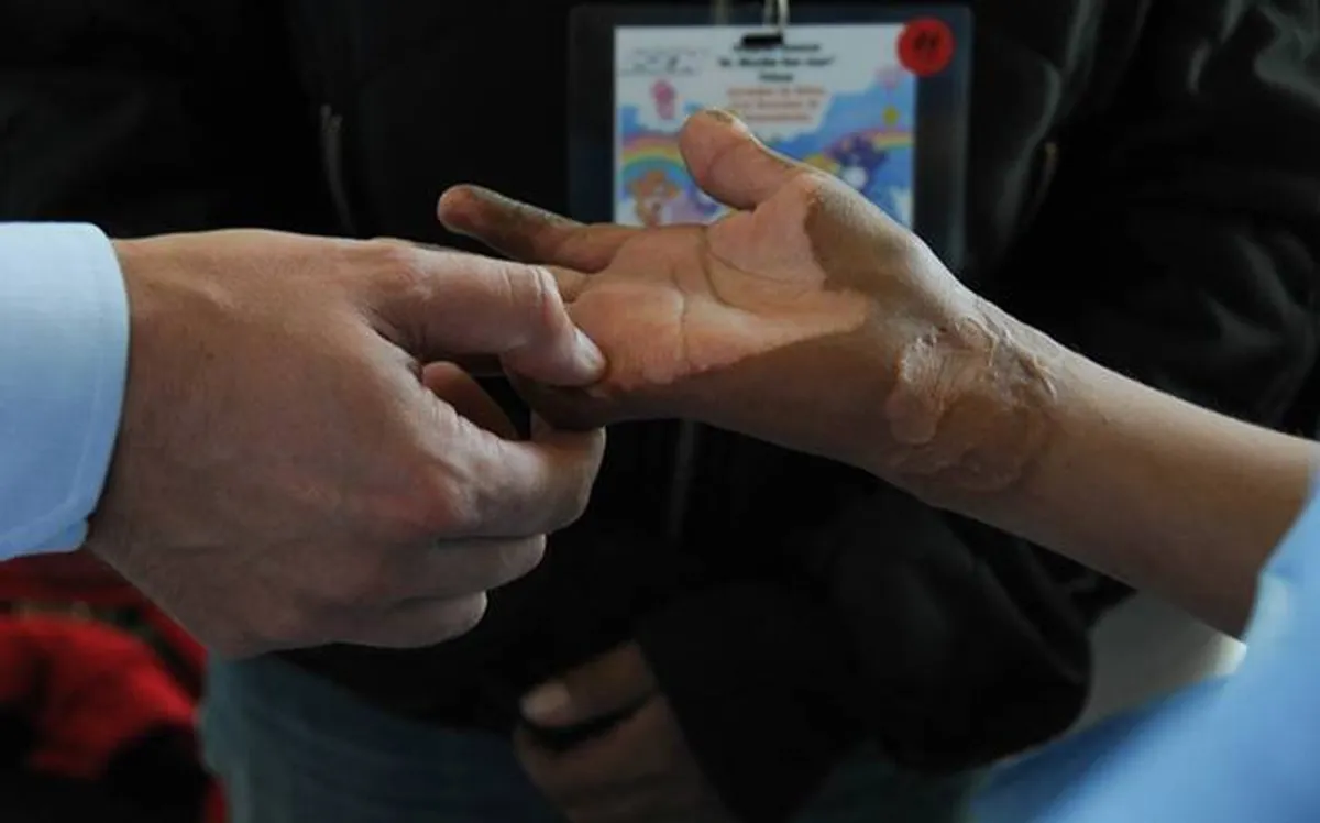 Edomex: en vacaciones aumentan 40% los accidentes en el hogar