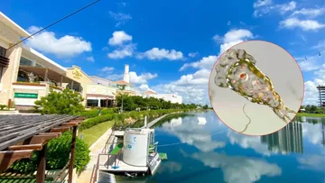 Ameba “comecerebro” en Yucatán: Fallecimiento de paciente podría ser por infección