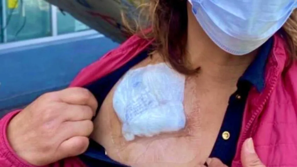 Fallece paciente renal por falta de hemodiálisis