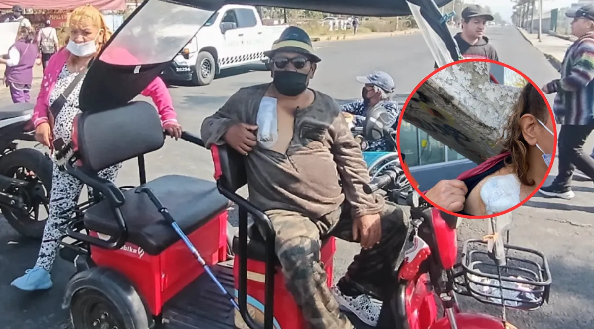 IMSS-Bienestar culpa a proveedor por falta de hemodiálisis en Neza; pacientes siguen en riesgo