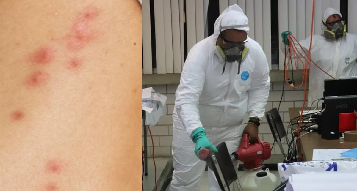Chinches causan alergias y daños en la piel: Dermatólogos