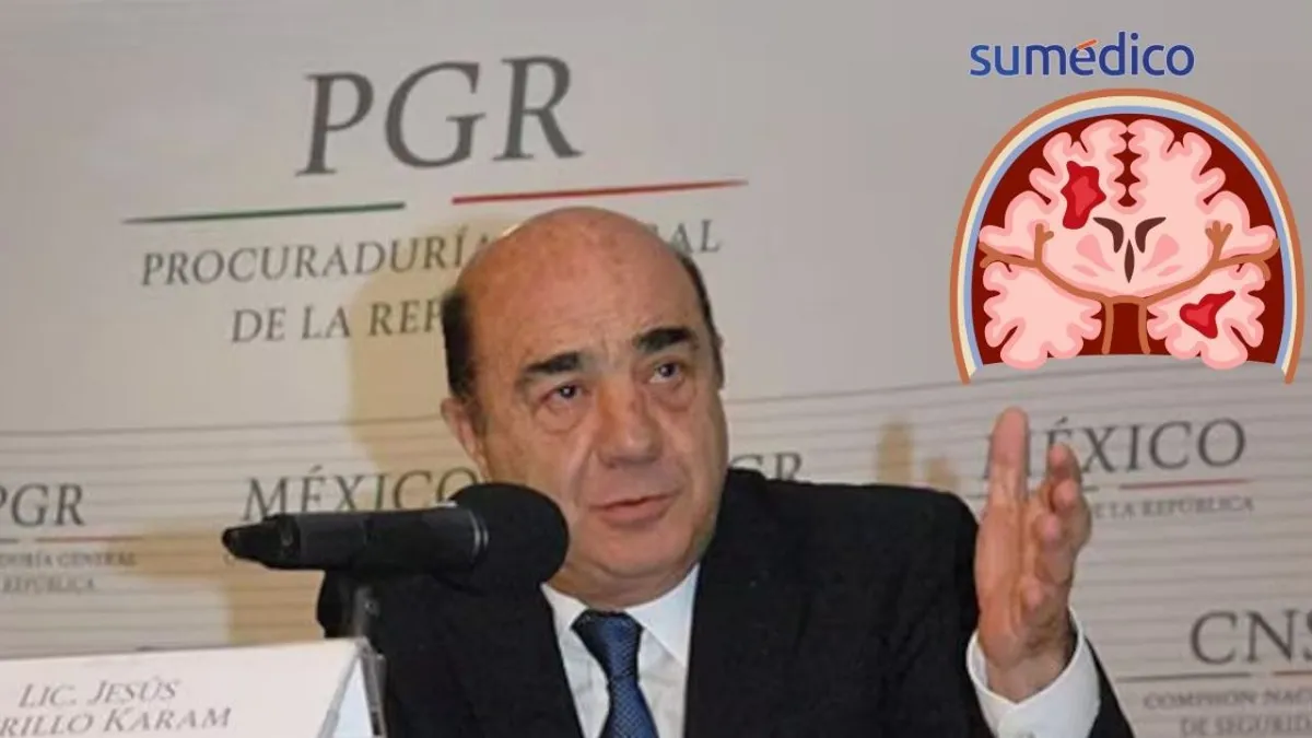 Salud de Murillo Karam: Reportan estado inestable tras sufrir derrame cerebral