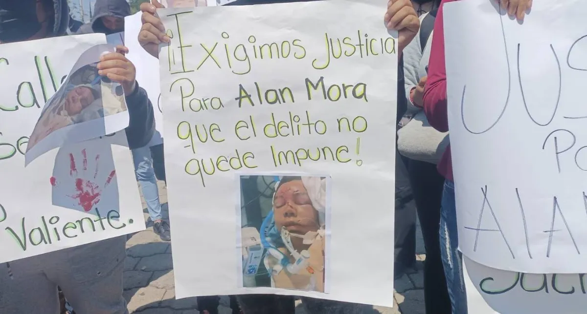 Acolman: Familiares de Jesús Mora, joven golpeado, exigen justicia