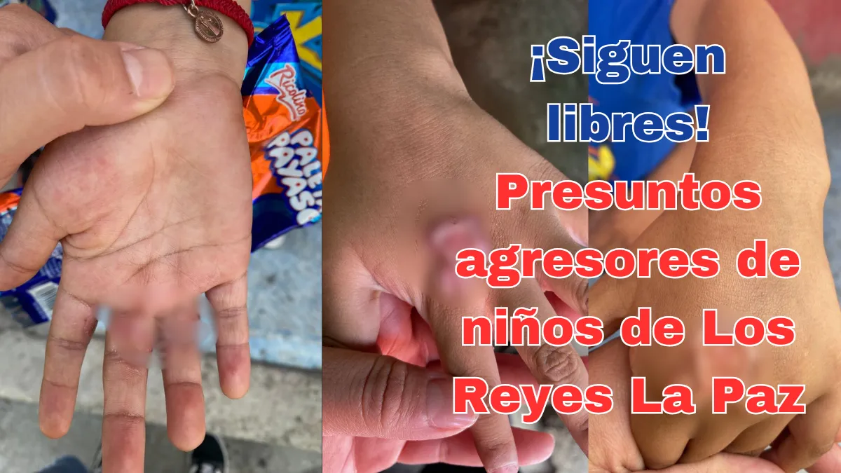 Familiares piden justicia para niños quemados en Los Reyes La Paz