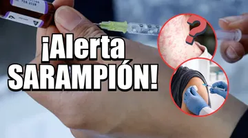 ¡Alerta por Sarampión! ¿Quiénes deben aplicarse la vacuna y cuál es la dosis en Edomex?