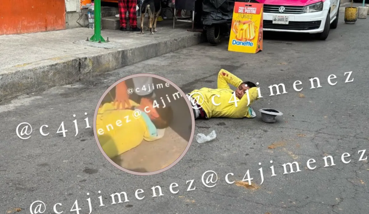[VIDEO] “¡Ay mi piernita!”: Ladrón de OXXOs llora tras ser herido al intentar huir de la policía