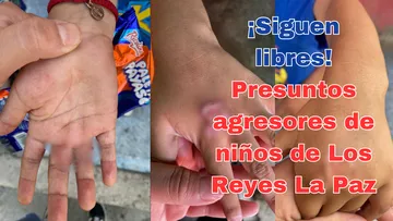 Familiares piden justicia para niños quemados en Los Reyes La Paz