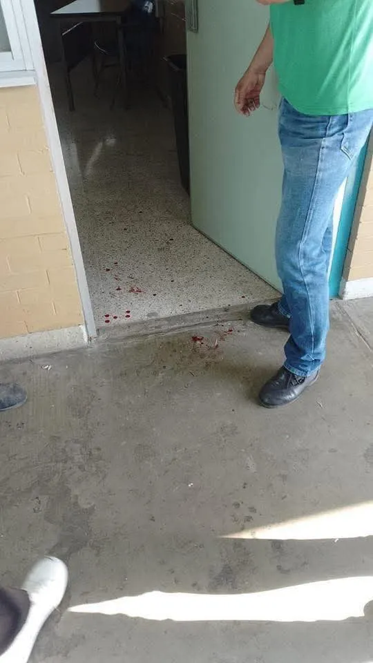 Alumno apuñala a profesor en CCH Naucalpan; se suspenden clases