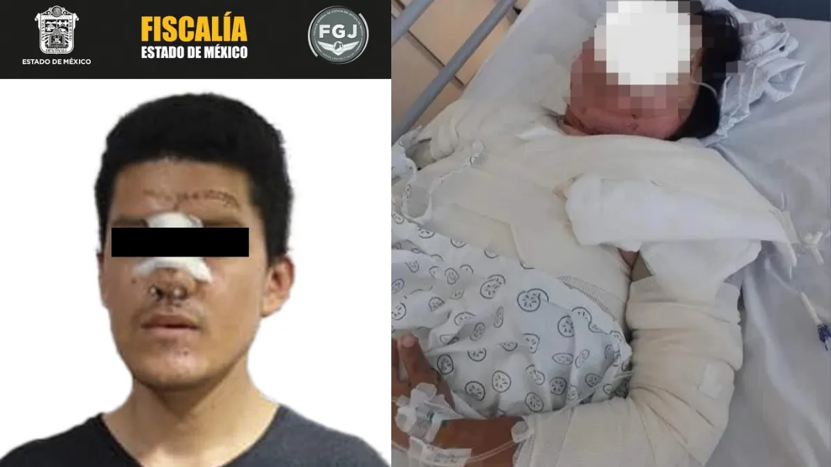 Colectivos piden justicia para víctima de quemaduras en Chimalhuacán