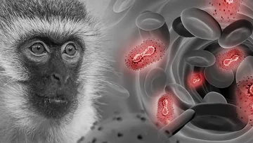 Viruela del Mono: Alerta por aumento del 89% en casos globales según la OMS