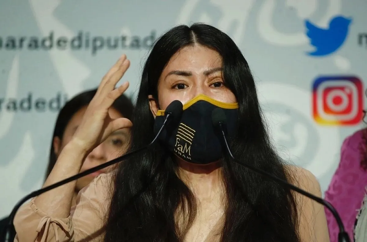 Denuncia saxofonista atacada con ácido que su agresor está libre