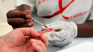 Edomex cerró 2025 con más de 20 mil casos de VIH; Salud opaca datos de 2026