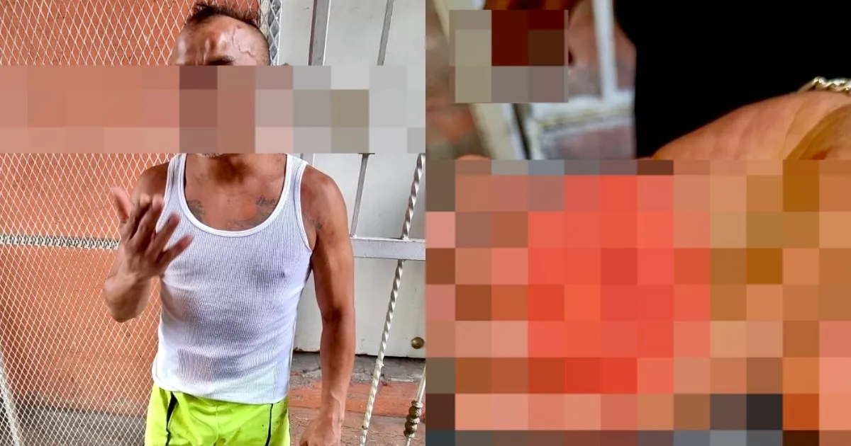 Se pelea y le muerde la oreja a su oponente, ya le apodan el ‘Tyson de la Morelos’
