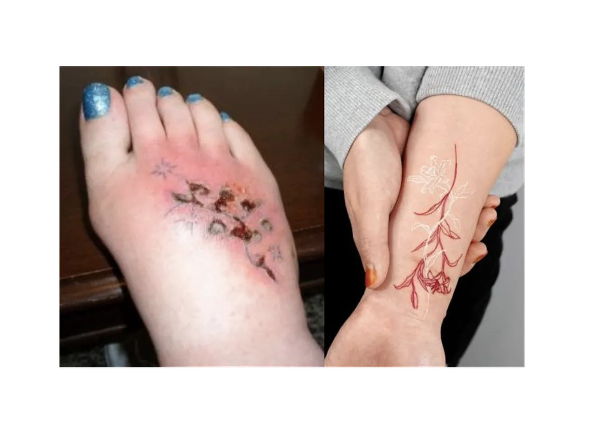 ¿Qué pasa cuando te tatúas?