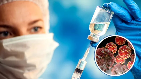 Tras confirmarse la primera muerte por sarampión en CDMX, autoridades revelan cuáles son las alcaldías con más casos activos.