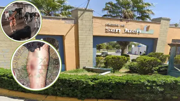Perros atacan a mujer en Zumpango; van al menos cinco casos