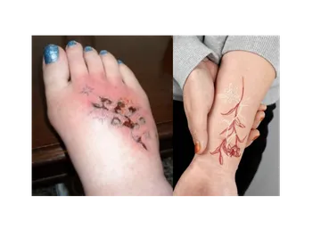 ¿Qué pasa cuando te tatúas?