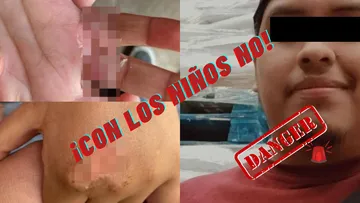 Terrible caso en Edomex: Queman manos a menores en Los Reyes La Paz; madre y padrastro fueron detenidos tras denuncia familiar.