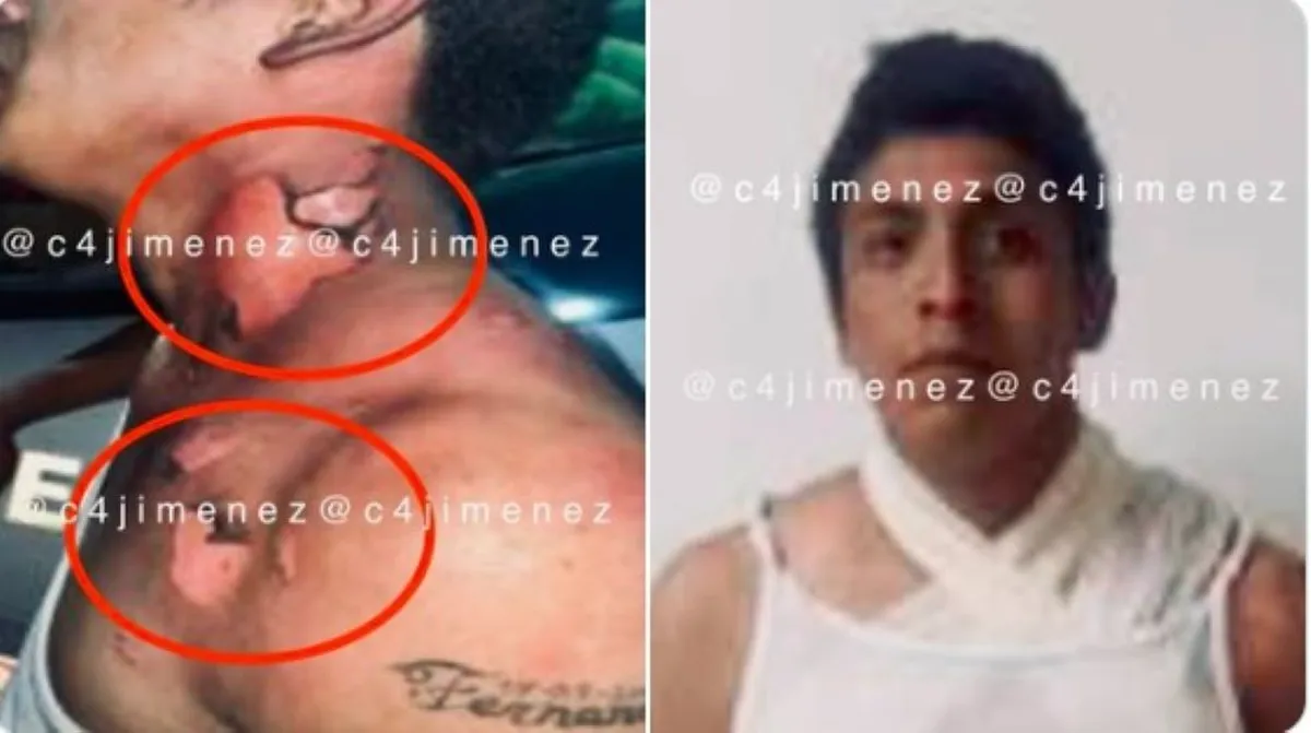 Dicho sujeto recibió y ejemplar castigo tras intentar robar a una mujer a la que amenazó con un cuchillo para despojarla de sus pertenencias. Foto: Captura