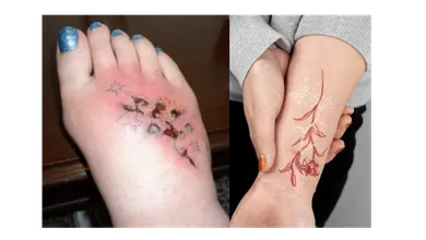 ¿Qué pasa cuando te tatúas?