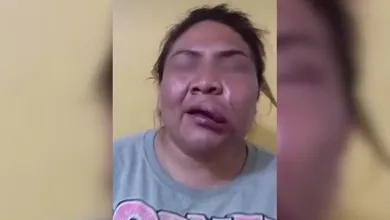 Autoridades de Naucalpan están pendientes del caso de tortura y tentativa de transfeminicidio