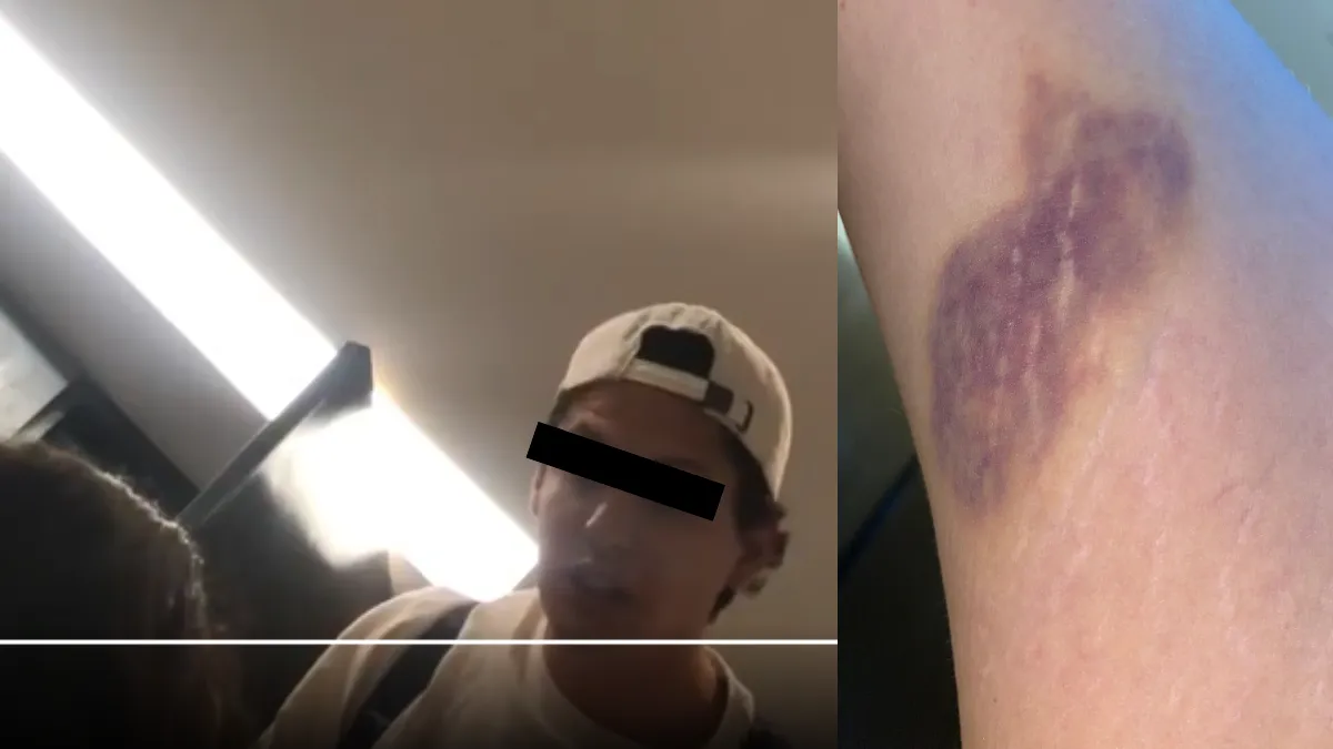 Universitaria de Puebla logra grabar agresión que le propinó su novio