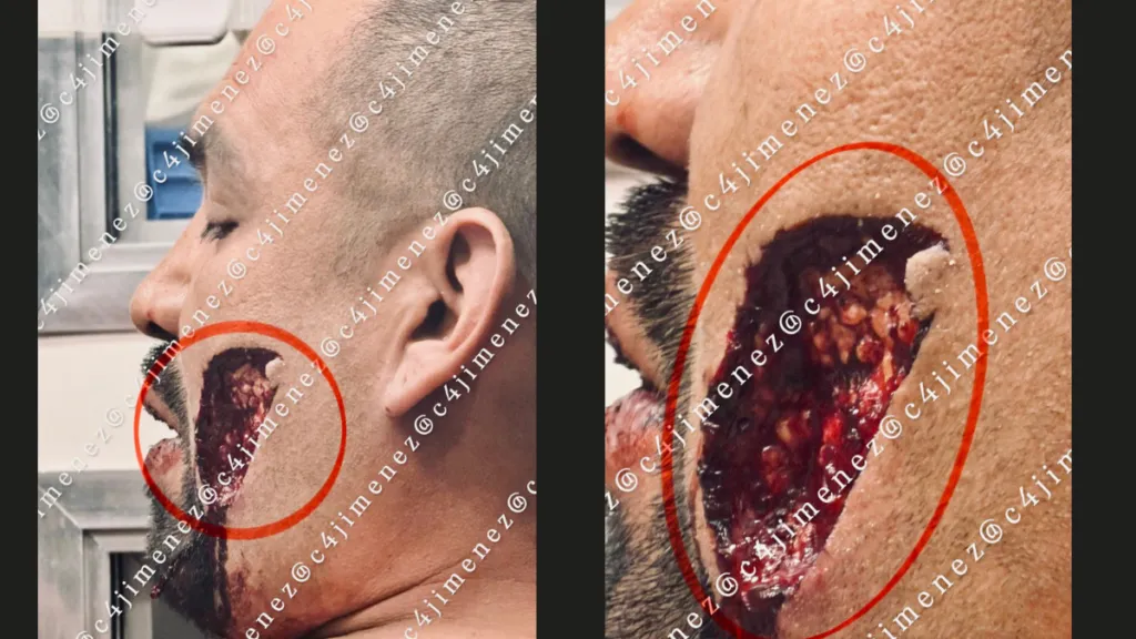 [Fuertes Imágenes] Le arranca cachete al agresor al defender a su prima por  agresión sexual en CDMX