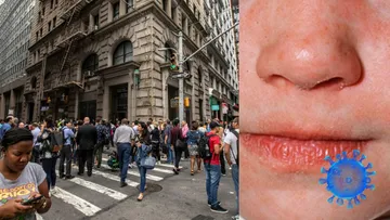 Brote de sarampión en Nueva York suma más de 100 casos en 2026
