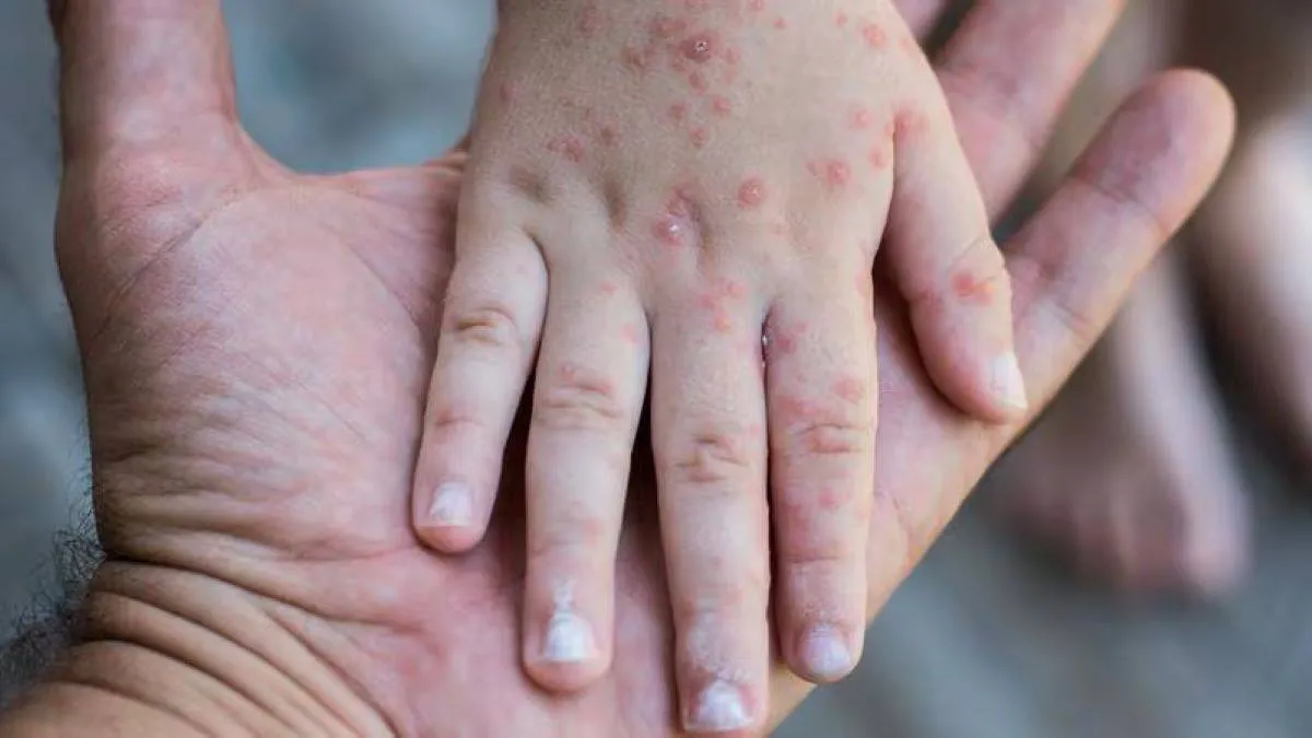 El kinder "Prof. Rosa María Quiroz de Camacho" reportó a las autoridades sanitarias una presunta aparición de virus Coxsackie. Foto: Captura.