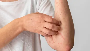 Hasta el momento, la situación se encuentra bajo control y que no se ha identificado un escenario de alerta sanitaria.