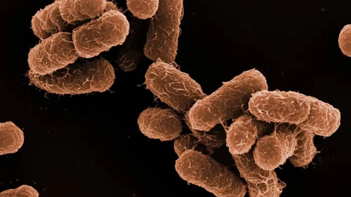 Alerta epidemiológica: detectan primer brote de Klebsiella oxytoca en México