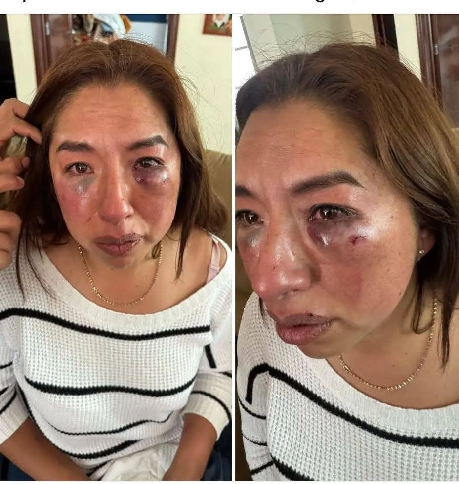 [VIDEO] Habitantes de Capulhuac exigen la destitución de la alcaldesa tras agresión a psicóloga del DIF
