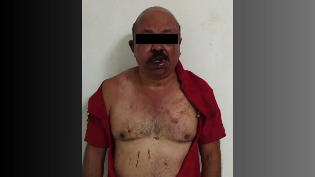 Dan golpiza a presunto chofer de aplicación por presuntamente intentar secuestrar a joven en Ecatepec