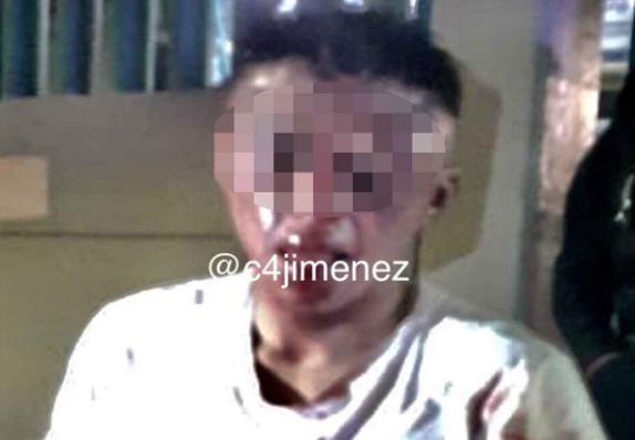 Brando Brayan golpeado tras asalto en Iztapalapa