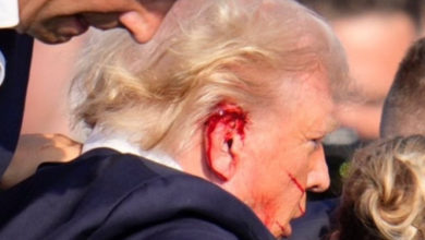 Bala contra Trump estuvo a 6 milímetros de entrar en su cabeza, explica su médico